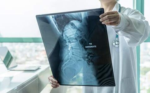 Röntgen ist eine notwendige diagnostische Methode, wenn der Rücken schmerzt